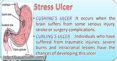 Curling's ulcer/Curling ulcer is an acute peptic ulcer of the duodenum ...