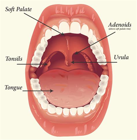 Tonsils and Adenoids. Causes, symptoms, treatment Tonsils and Adenoids