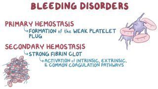 Ecchymosis: What Is It, Causes, Symptoms, and More | Osmosis