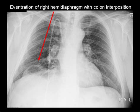 On Call Radiology - common radiology findings on call and in the ...