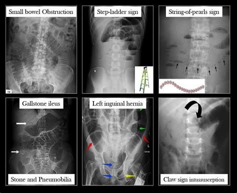 Pin van Luisvaldivieso op abdomen-pelvis | Universiteit