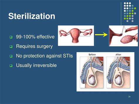 PPT - Birth Control Methods PowerPoint Presentation, free download - ID ...