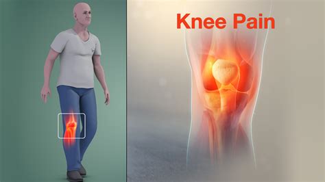 Knee Pain Causes Signs Symptoms Diagnosis And Treatment Hot Sex Picture ...