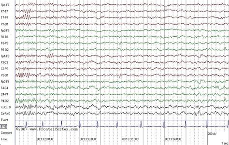 eeg - DriverLayer Search Engine