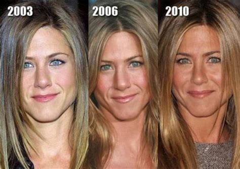 Celebrity Plastic Surgery Before & After (56 pics) - Izismile.com