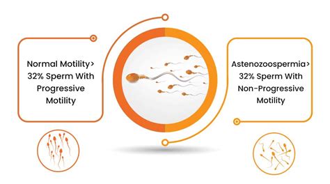 Asthenozoospermia: Definition & Diagnosis Method