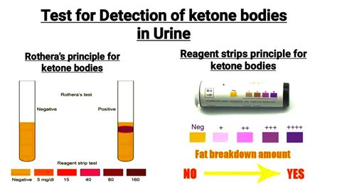 Chemical Examination of urine | Detection of ketone bodies in urine ...