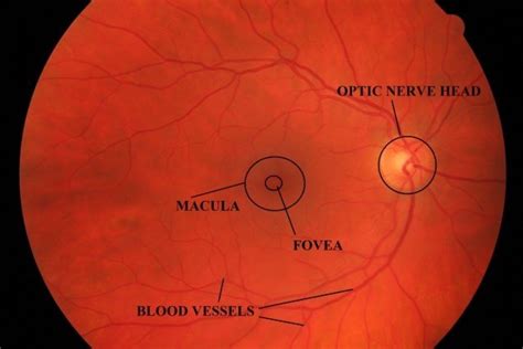 Fundus of human eye | Download Scientific Diagram