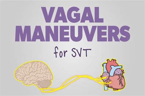 Vagal Maneuvers: How to Stop your Patient’s SVT | Health And Willness