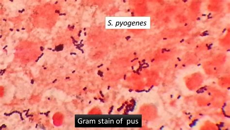 Streptococcus Pyogenes Gram Stain