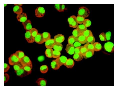 Determination of apoptotic cells by acridine orange staining of A549 ...