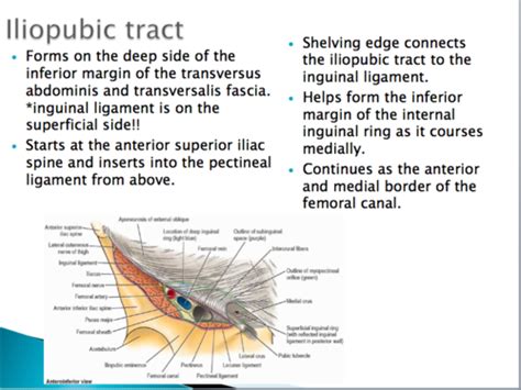 Iliopubic Tract Vs Inguinal Ligament