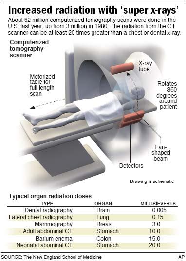 Radiation Dose: What Is The Radiation Dose Of A Ct Scan