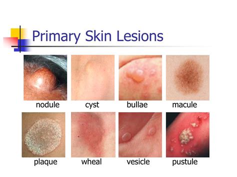 PPT - Non-Infectious Skin Diseases PowerPoint Presentation, free ...