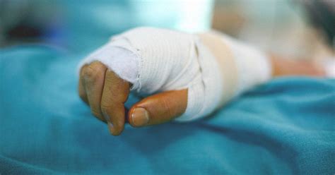 Degloving: Images, Types, Treatment, and Complications