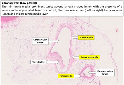 Arteries And Veins Histology