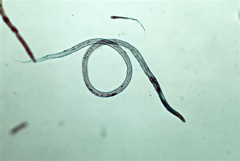 Overview of Roundworms in Dogs