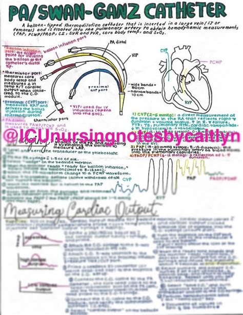 Anatomy of a Swan-ganz/pulmonary Artery Catheter PAC & Thermodilution ...