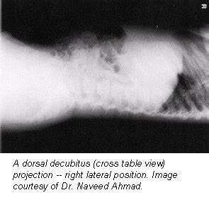 Dorsal and lateral decubitus patient positioning for abdominal x-ray ...