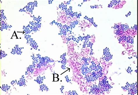 CuriouSTEM - What is the Acid-Fast Stain, and how do we use it?