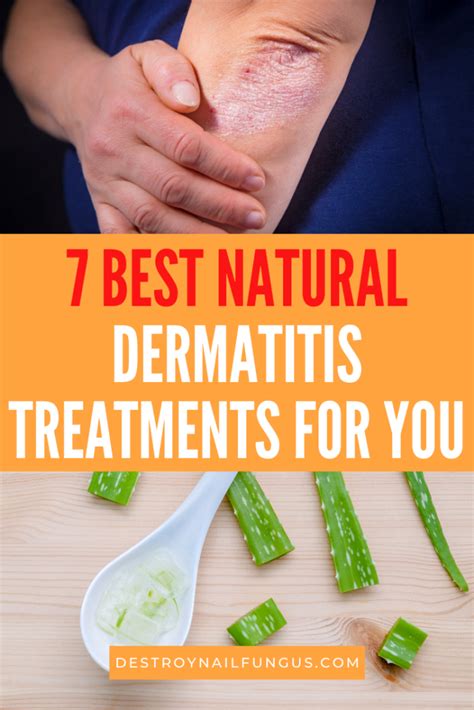 Dermatitis Remedies: Natural Treatments For Eczema Relief