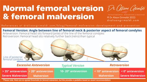 Femoral Anteversiyon