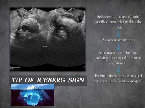 Basic gynae ultrasound