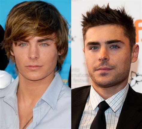 Zac Efron - has he used plastic surgeries?