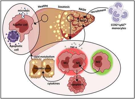 Frontiers | Ontogeny and Polarization of Macrophages in Inflammation ...