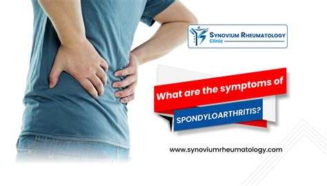 What are the symptoms of Spondyloarthritis? | Synovium Rheumatology