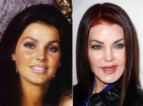 28 Celebrity Plastic Surgery Nightmares - Priscilla Presley Before And ...