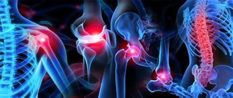 Two Common Orthopedic Conditions—and How to Treat Them.