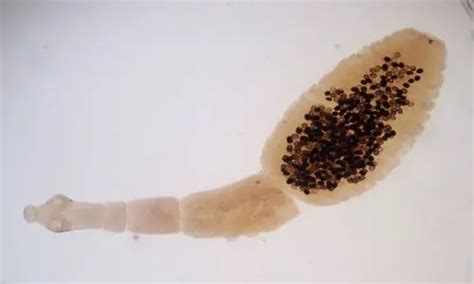 Echinococcus granulosus: Morphology, Life Cycle and Pathogenesis