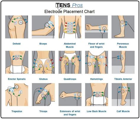 Image result for hip flexor tens placement | Ten unit, Tens electrode ...