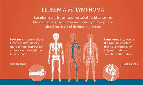 Lymphoma vs. Leukemia: Understanding the Differences