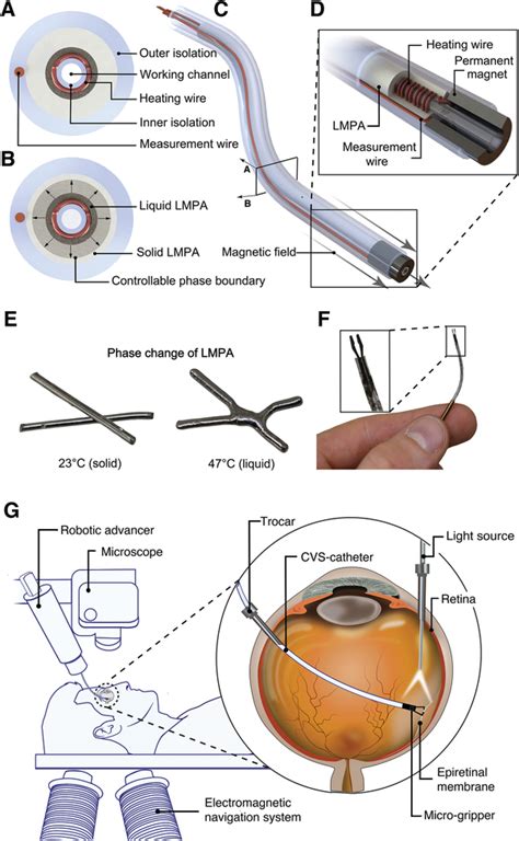 Robotic epiretinal membrane peeling surgery in an eye phantom A) Setup ...