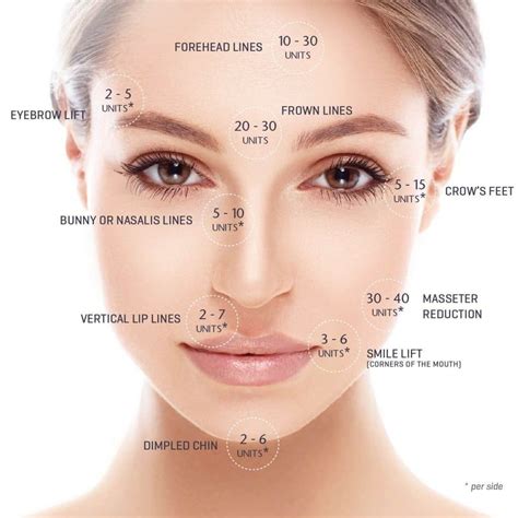 Botox unit amounts per area. #botox | Botox lips, Facial aesthetics, Botox