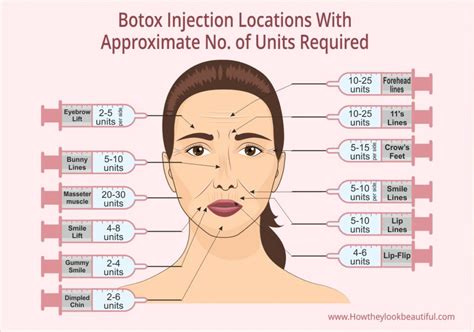 How long does it take to see botox results? (With Timeline)