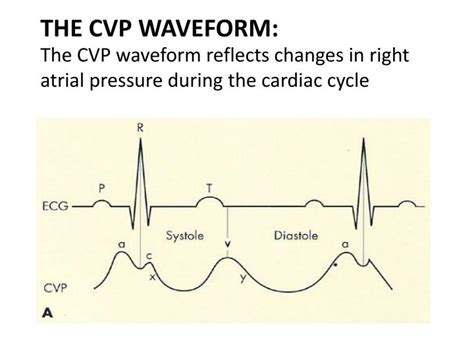 PPT - Central Venous Line (CVL) AND Central Venous Pressure (CVP ...