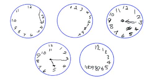 Examples of clock drawings produced by people diagnosed with dementia ...