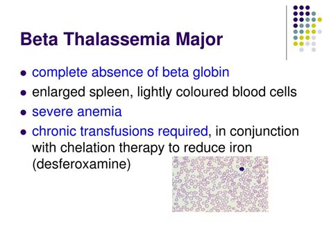 PPT - Thalassemia & Treatment PowerPoint Presentation, free download ...