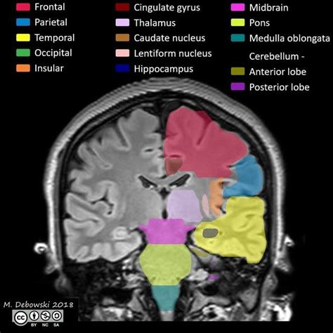 Radiology Quiz 61691 | Radiopaedia.org | Radiology, Radiology student ...