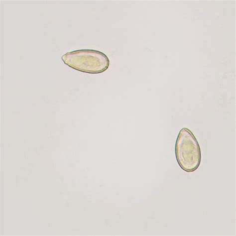 Buy Clonorchis sinensis Egg, w.m. Microscope Slide Online at Low Prices ...