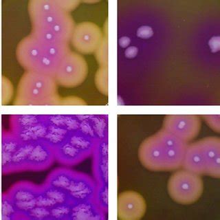 Colony morphology of the B. cereus isolates from microgreen and water ...