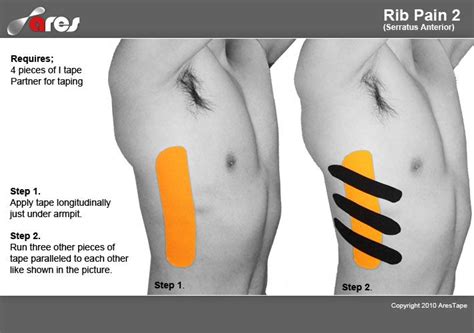 1000+ images about Kinesiology Tape: Ares on Pinterest | Knee pain ...