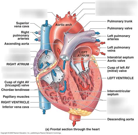 Conus Arteriosus Heart