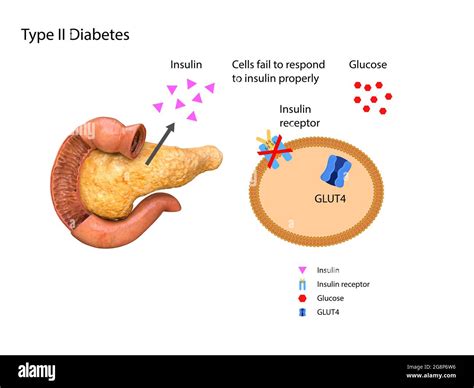 schematic illustration of the pancreas and stomach in insulin levels ...