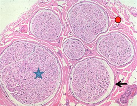 Nerve Fascicle Histology