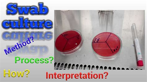 Labcorp Aerobic And Anaerobic Culture Swab at Francis Seaman blog