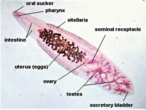 Opisthorchis Sinensis